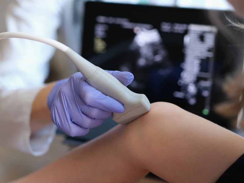 Ultrassom Articulação