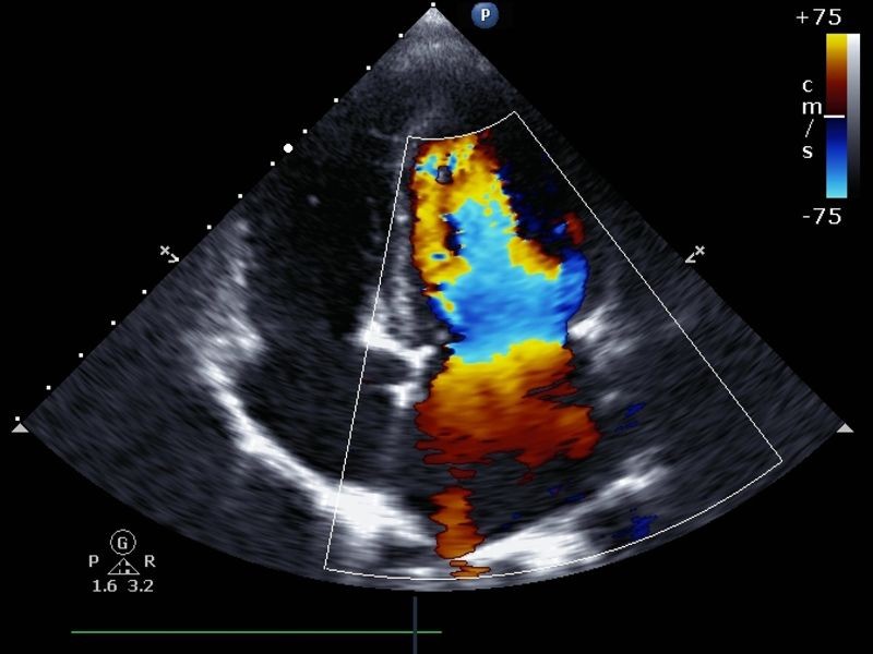 Ultrassom Abdome Superior com Doppler