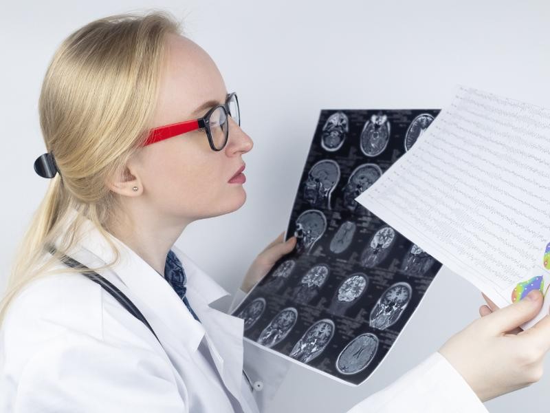 Eletroencefalograma (EEG)
