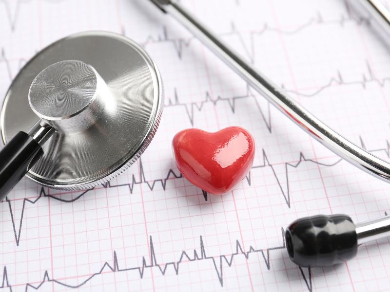 Exames Cardiológicos